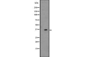 Western blot analysis of OR2T6 expression in ZR-75-1 cell line lysate ,The lane on the left is treated with the antigen-specific peptide. (OR2T6 抗体  (C-Term))