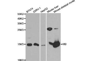 Western Blotting (WB) image for anti-MB antibody (ABIN1876659) (MB 抗体)