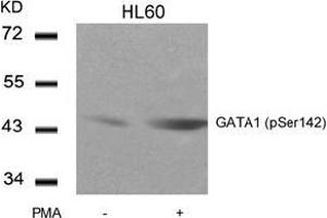 Image no. 3 for anti-GATA Binding Protein 1 (Globin Transcription Factor 1) (GATA1) (pSer142) antibody (ABIN196684) (GATA1 抗体  (pSer142))