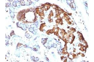 Formalin-fixed, paraffin-embedded rat pancreas stained with TNF alpha antibody. (TNF alpha 抗体)