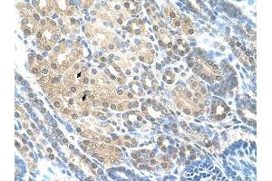 RAD23A antibody was used for immunohistochemistry at a concentration of 4-8 ug/ml to stain Epithelial cells of renal tubule (arrows) in Human Kidney. (RAD23A 抗体)
