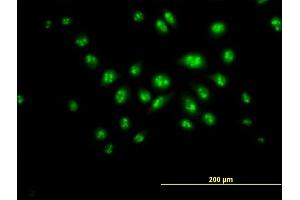 Immunofluorescence of purified MaxPab antibody to DKC1 on HeLa cell. (DKC1 抗体  (AA 1-514))