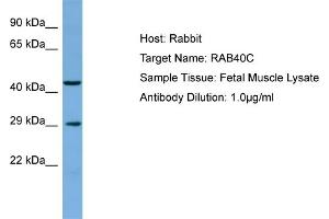 Host: Rabbit Target Name: RAB40C Sample Type: Fetal Muscle lysates Antibody Dilution: 1. (RAB40C 抗体  (C-Term))