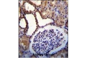WNK3(PRKWNK3) Antibody (C-term) (ABIN391067 and ABIN2841218) immunohistochemistry analysis in formalin fixed and paraffin embedded human kidney tissue followed by peroxidase conjugation of the secondary antibody and DAB staining. (WNK3 抗体  (C-Term))