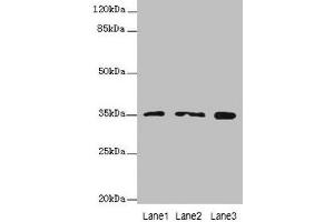 Western blot All lanes: FAHD2A antibody at 0. (FAHD2A 抗体  (AA 4-314))