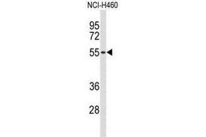 Western blot analysis of ACCN1 Antibody (Center) in NCI-H460 cell line lysates (35 µg/lane). (ACCN1 抗体  (Middle Region))