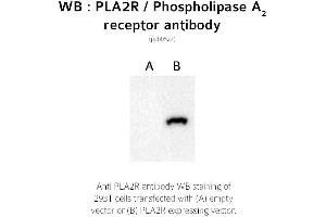 Image no. 1 for anti-phospholipase A2 Receptor 1, 180kDa (PLA2R1) (C-Term) antibody (ABIN347711) (PLA2R1 抗体  (C-Term))
