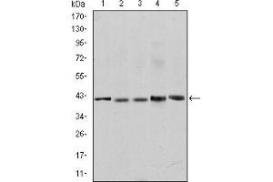 Western blot analysis using c-Rel mouse mAb against Jurkat (1), NIH/3T3 (2), Hela (3), HEK293 (4) and RAJI (5) cell lysate.