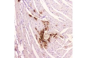 IHC analysis of ANP using anti-ANP antibody (ABIN5693163). (NPPA 抗体  (AA 25-122))