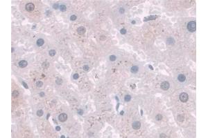 Detection of SPINT2 in Human Liver Tissue using Polyclonal Antibody to Serine Peptidase Inhibitor Kunitz Type 2 (SPINT2) (SPINT2 抗体  (AA 28-197))