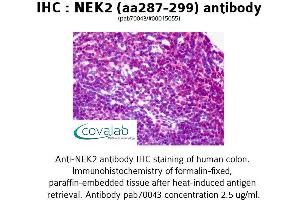 Image no. 2 for anti-NIMA (Never in Mitosis Gene A)-Related Kinase 2 (NEK2) (AA 287-299) antibody (ABIN1737250)