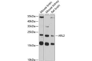 Western blot analysis of extracts of various cell lines, using  antibody (ABIN3016794, ABIN3016795, ABIN3016796 and ABIN6219841) at 1:3000 dilution. (ARL2 抗体  (AA 1-184))