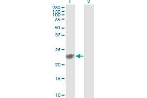 Western Blot analysis of GSTP1 expression in transfected 293T cell line by GSTP1 monoclonal antibody (M01), clone 2G6-F6. (GSTP1 抗体  (AA 1-210))