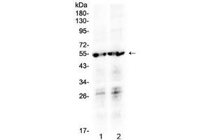 Western blot testing of human 1) SW620 and 2) MCF7 cell lysate with PTGER4 antibody at 0.