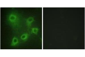 Immunofluorescence analysis of COS7 cells, using SYK (Ab-323) Antibody. (SYK 抗体  (AA 289-338))