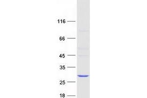 Western Blotting (WB) image for COMM Domain Containing 2 (COMMD2) protein (Myc-DYKDDDDK Tag) (ABIN2712443)