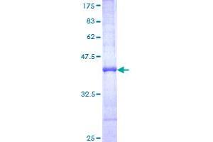 Image no. 1 for Plectin (PLEC) (AA 4384-4493) protein (GST tag) (ABIN1315362) (PLEC Protein (AA 4384-4493) (GST tag))