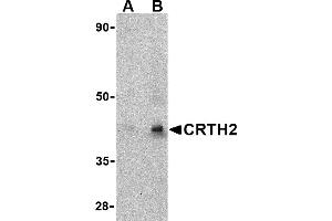 Western blot analysis of CRTH2 in human heart tissue lysate with CRTH2 antibody at (A) 1 and (B) 2 µg/mL. (Prostaglandin D2 Receptor 2 (PTGDR2) (Middle Region) 抗体)