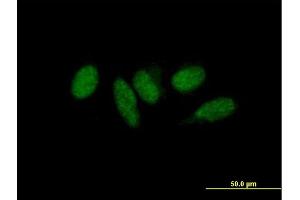 Immunofluorescence of purified MaxPab antibody to MED9 on HeLa cell. (MED9 抗体  (AA 1-146))
