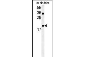 CCDC12 Antibody (N-term) (ABIN657883 and ABIN2846838) western blot analysis in mouse bladder tissue lysates (15 μg/lane). (CCDC12 抗体  (N-Term))