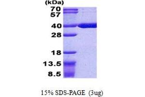 SDS-PAGE (SDS) image for Acyl-CoA Thioesterase 8 (ACOT8) (AA 1-319) protein (His tag) (ABIN5852990) (ACOT8 Protein (AA 1-319) (His tag))