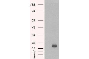 HEK293 overexpressing BAALC (ABIN5339300) and probed with ABIN334357 (mock transfection in first lane). (BAALC 抗体  (Internal Region))