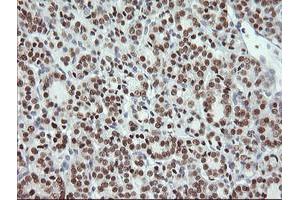 Image no. 2 for anti-Musashi Homolog 1 (Drosophila) (MSI1) antibody (ABIN1499573) (MSI1 抗体)