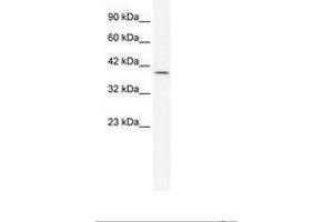 Image no. 1 for anti-Gastrulation Brain Homeo Box 2 (GBX2) (AA 181-230) antibody (ABIN202301) (GBX2 抗体  (AA 181-230))