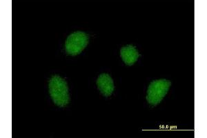 Immunofluorescence of purified MaxPab antibody to ZNF710 on HeLa cell. (ZNF710 抗体  (AA 1-664))