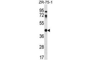 CTSO Antibody (N-term) western blot analysis in ZR-75-1 cell line lysates (35µg/lane). (CTSO 抗体  (N-Term))