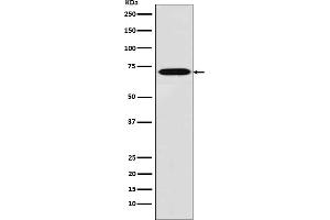 Western blot analysis of Plastin L expression in THP1 cell lysate.