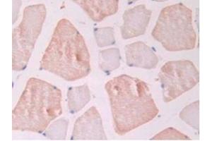 IHC-P analysis of Rat Skeletal Muscle Tissue, with DAB staining. (Endoglin 抗体  (AA 26-136))