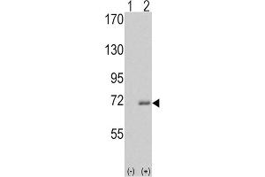 Western blot analysis of IRAK1 (arrow) using rabbit polyclonal IRAK Antibody (C-term). (IRAK1 抗体)