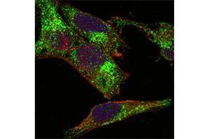 Confocal immunofluorescence analysis of Hela cells using INHA mouse mAb (green). (Inhibin alpha 抗体)