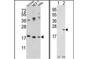 Western blot analysis of CFL1 Antibody (N-term) (ABIN389443 and ABIN2839515) in MCF-7,Hela cell line and mouse brain tissue lysates (35 μg/lane).