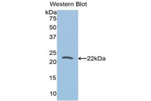 Western Blotting (WB) image for anti-Tumor Protein, Translationally-Controlled 1 (TPT1) (AA 1-172) antibody (ABIN5662059) (TPT1 抗体  (AA 1-172))