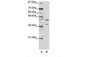 Image no. 2 for anti-Heterogeneous Nuclear Ribonucleoprotein K (HNRNPK) (AA 371-420) antibody (ABIN203155) (HNRNPK 抗体  (AA 371-420))