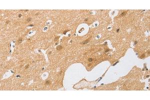 Immunohistochemistry of paraffin-embedded Human brain tissue using CEBP beta Polyclonal Antibody at dilution 1:60 (CEBPB 抗体)