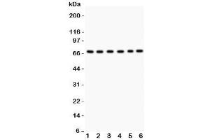 Western blot testing of PKC iota antibody and Lane 1:  SHG-44;  2: A549;  3: U87;  4: 293T;  5: HeLa;  6: Jurkat. (PKC iota 抗体  (AA 21-214))