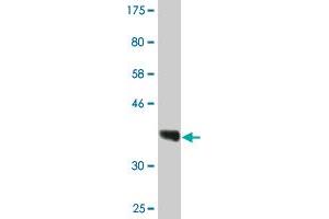 Western Blot detection against Immunogen (36. (RPRD1A 抗体  (AA 76-170))