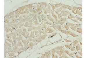 Immunohistochemistry of paraffin-embedded human heart tissue using ABIN7173581 at dilution of 1:100 (TNNI2 抗体  (AA 1-100))