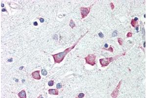 Human Brain, Cortex (formalin-fixed, paraffin-embedded) stained with DAPK3 antibody ABIN214482 at 2. (DAPK3 抗体  (Internal Region))