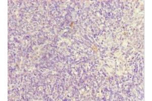 Immunohistochemistry of paraffin-embedded human thymus tissue using ABIN7169185 at dilution of 1:100 (SIK3 抗体  (AA 60-310))
