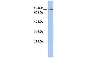 WB Suggested Anti-ZNF711 Antibody Titration:  0. (ZNF711 抗体  (N-Term))