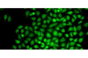 Immunofluorescence analysis of MCF-7 cells using CTCFL Polyclonal Antibody (CTCFL 抗体)