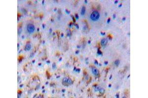 IHC-P analysis of Liver tissue, with DAB staining. (HFE2 抗体  (AA 29-401))
