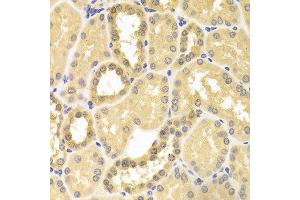 Immunohistochemistry of paraffin-embedded human kidney using IDE antibody at dilution of 1:100 (x400 lens). (IDE 抗体)