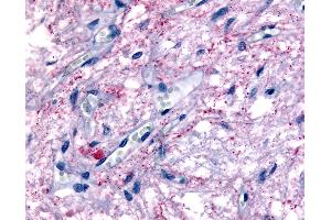 Anti-GPR50 antibody IHC of human pituitary. (GPR50 抗体  (Cytoplasmic Domain))