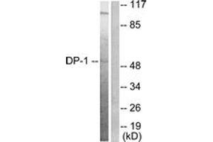 Western blot analysis of extracts from HeLa cells, using DP-1 Antibody. (TGM4 抗体  (AA 361-410))