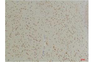 Immunohistochemistry (IHC) analysis of paraffin-embedded Mouse Brain Tissue using GABA Transporter 1 Rabbit Polyclonal Antibody diluted at 1:200. (SLC6A1 抗体)